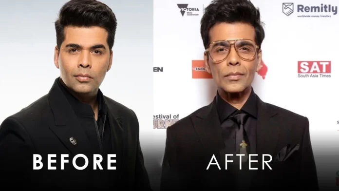 Karan Johar's Weight Loss