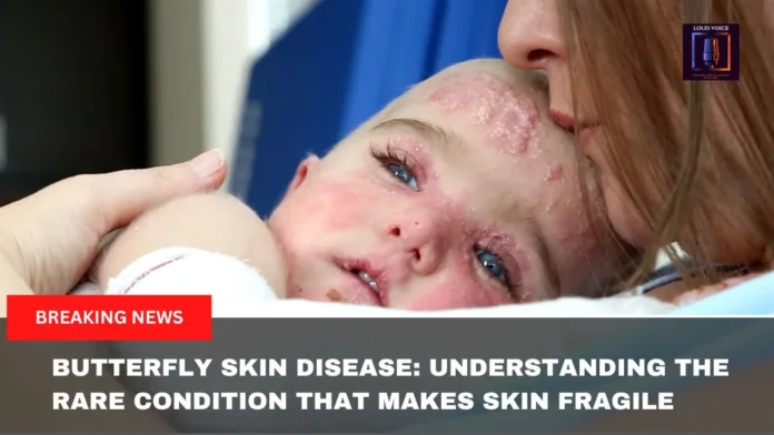 Butterfly Skin Disease
